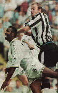 Shearer gets a brace