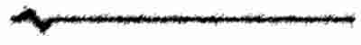 ecgblack2.jpg (6424 bytes)