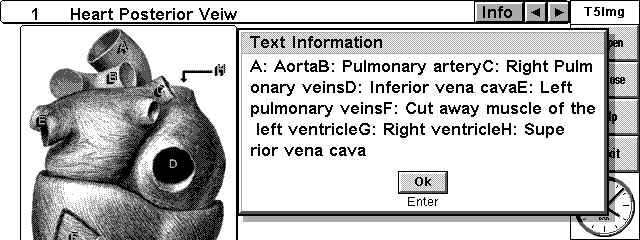 heartimg.bmp (460854 bytes)