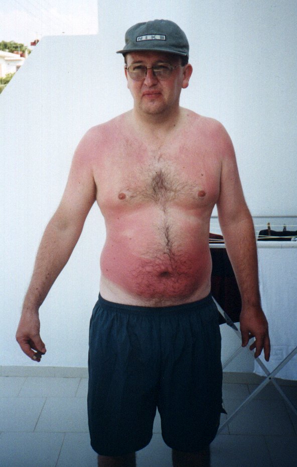Crete Day 1 - Me Overdone, July 99